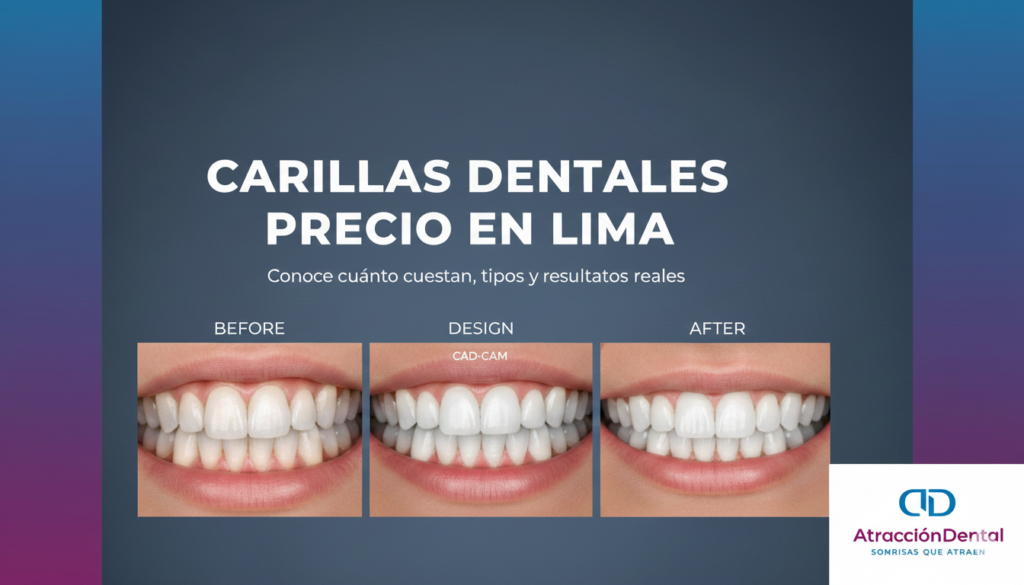 carillas dentales precio en Lima antes y después