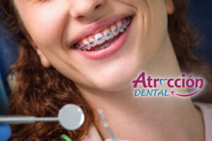 Tratamiento de brackets en Lima