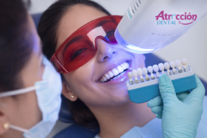 Blanqueamiento dental en lima