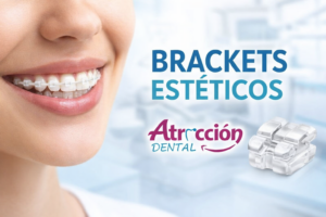 Brackets estéticos precio en Lima – tratamiento en Atracción Dental