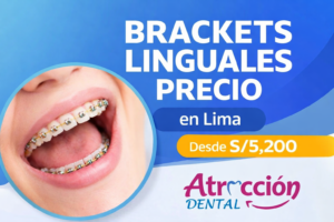 Brackets linguales precio en lima Atención en Atracción Dental