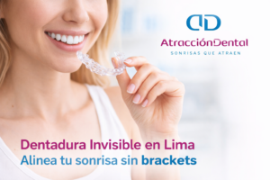 dentadura invisible en lima alineadores transparentes ortodoncia invisible mujer sonriendo