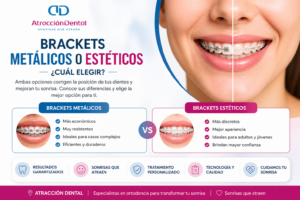 brackets metálicos o estéticos comparación de opciones Atracción Dental
