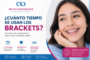 cuánto tiempo se usan los brackets duración del tratamiento Atracción Dental