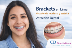 Paciente sonriendo con brackets estéticos en clínica dental de Lima con tratamiento de ortodoncia en Atracción Dental.