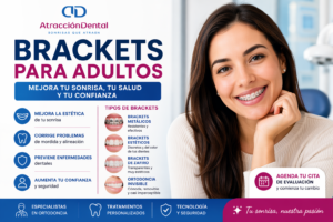 Mujer adulta sonriendo con brackets metálicos en una clínica dental, acompañada de información sobre tipos de brackets para adultos, beneficios del tratamiento y logo de Atracción Dental.